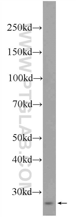 RNF151 Rabbit anti-Human, Mouse, Rat, Polyclonal, Proteintech 150 μL;