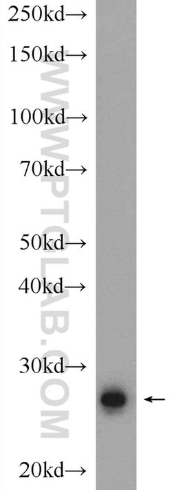 RNF151 Rabbit anti-Human, Mouse, Rat, Polyclonal, Proteintech 150 μL;