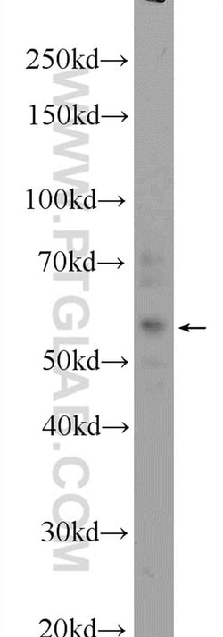 ZFP2 Rabbit anti-Human, Mouse, Polyclonal, Proteintech 150 &mu;L | Buy Online | Proteintech Group Inc | Fisher Scientific