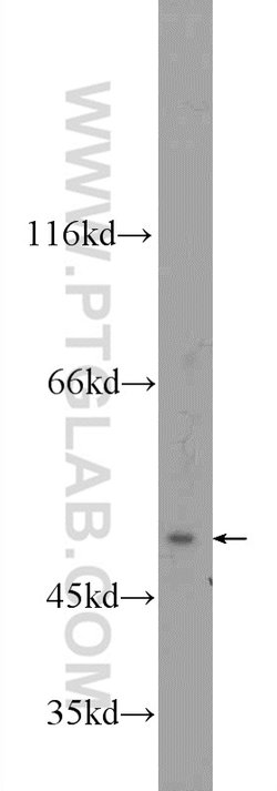 ZFP2 Rabbit anti-Human, Mouse, Polyclonal, Proteintech 150 &mu;L | Buy Online | Proteintech Group Inc | Fisher Scientific