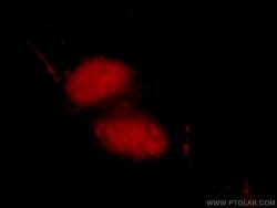 MDC1 Rabbit anti-Human, Polyclonal, Proteintech 150 &mu;L; Unconjugated:Antibodies,