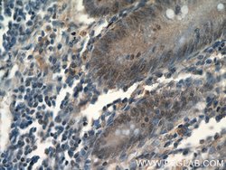MDC1 Rabbit anti-Human, Polyclonal, Proteintech 150 &mu;L; Unconjugated:Antibodies,