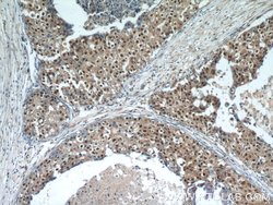 MDC1 Rabbit anti-Human, Polyclonal, Proteintech 150 &mu;L; Unconjugated:Antibodies,