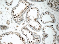 MDC1 Rabbit anti-Human, Polyclonal, Proteintech 150 &mu;L; Unconjugated:Antibodies,