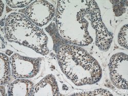 BTBD16 Rabbit anti-Human, Mouse, Polyclonal, Proteintech 150 &mu;L; Unconjugated:Antibodies,