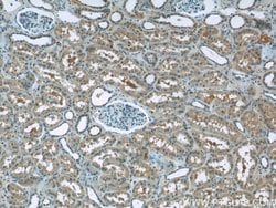 BTBD16 Rabbit anti-Human, Mouse, Polyclonal, Proteintech 150 &mu;L; Unconjugated:Antibodies,