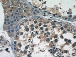 BTBD16 Rabbit anti-Human, Mouse, Polyclonal, Proteintech 150 &mu;L; Unconjugated:Antibodies,