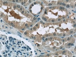 BTBD16 Rabbit anti-Human, Mouse, Polyclonal, Proteintech 150 &mu;L; Unconjugated:Antibodies,