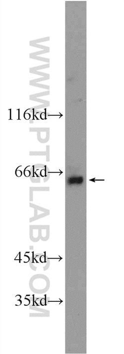 BTBD16 Rabbit anti-Human, Mouse, Polyclonal, Proteintech 150 &mu;L; Unconjugated:Antibodies,