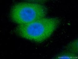 VHL Rabbit anti-Human, Polyclonal, Proteintech 150 &mu;L; Unconjugated:Antibodies,