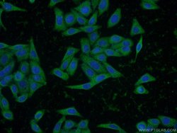 INSIG2 Rabbit anti-Human, Mouse, Rat, Polyclonal, Proteintech:Antibodies:Primary