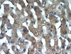 INSIG2 Rabbit anti-Human, Mouse, Rat, Polyclonal, Proteintech:Antibodies:Primary