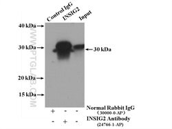 INSIG2 Rabbit anti-Human, Mouse, Rat, Polyclonal, Proteintech:Antibodies:Primary