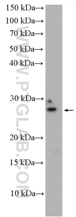 INSIG2 Rabbit anti-Human, Mouse, Rat, Polyclonal, Proteintech:Antibodies:Primary