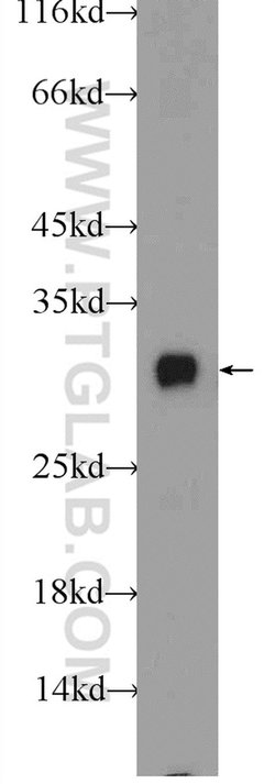 INSIG2 Rabbit anti-Human, Mouse, Rat, Polyclonal, Proteintech:Antibodies:Primary