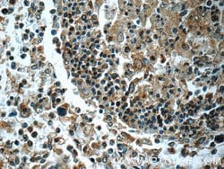 LRMP Rabbit anti-Human, Polyclonal, Proteintech:Antibodies:Primary Antibodies
