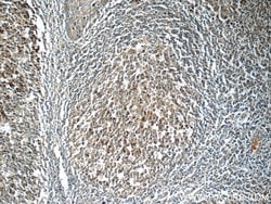 LRMP Rabbit anti-Human, Polyclonal, Proteintech:Antibodies:Primary Antibodies
