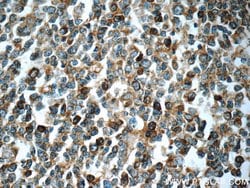 LRMP Rabbit anti-Human, Polyclonal, Proteintech:Antibodies:Primary Antibodies