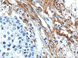 EMILIN2 Rabbit anti-Human, Polyclonal, Proteintech 20 &mu;L | Buy Online | Proteintech | Fisher Scientific