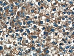 MOSC2 Rabbit anti-Human, Mouse, Polyclonal, Proteintech 150 &mu;L | Buy Online | Proteintech Group Inc | Fisher Scientific