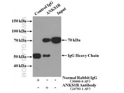 ANKS1B Rabbit anti-Human, Mouse, Polyclonal, Proteintech 150 &mu;L | Buy Online | Proteintech Group Inc | Fisher Scientific
