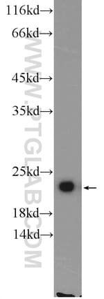 Thumbnail_TMEM35 Rabbit anti-Human, Mouse, Polyclonal, Proteintech 20 &mu;L; Unconjugated:Anticuerpos
