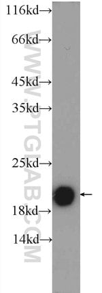 Thumbnail_TMEM35 Rabbit anti-Human, Mouse, Polyclonal, Proteintech 20 &mu;L; Unconjugated:Anticuerpos