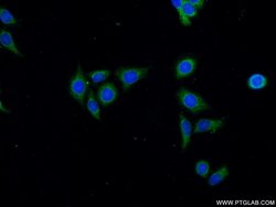 PIK3C2B Rabbit anti-Human, Polyclonal, Proteintech:Antibodies:Primary Antibodies