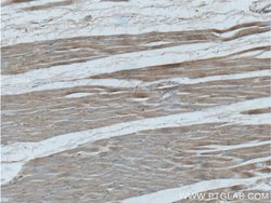 PIK3C2B Rabbit anti-Human, Polyclonal, Proteintech:Antibodies:Primary Antibodies