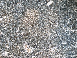 NALP1 Rabbit anti-Human, Polyclonal, Proteintech 150 &mu;L | Buy Online | Proteintech Group Inc | Fisher Scientific