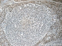 NALP1 Rabbit anti-Human, Polyclonal, Proteintech 150 &mu;L | Buy Online | Proteintech Group Inc | Fisher Scientific