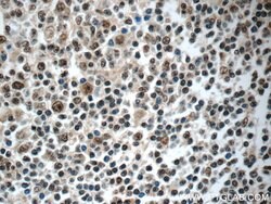 NALP1 Rabbit anti-Human, Polyclonal, Proteintech 150 &mu;L | Buy Online | Proteintech Group Inc | Fisher Scientific