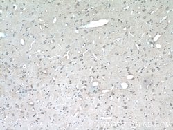 C15orf29 Rabbit anti-Human, Mouse, Rat, Polyclonal, Proteintech:Antibodies:Primary