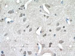 C15orf29 Rabbit anti-Human, Mouse, Rat, Polyclonal, Proteintech:Antibodies:Primary