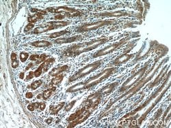 C15orf29 Rabbit anti-Human, Mouse, Rat, Polyclonal, Proteintech:Antibodies:Primary