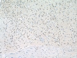C15orf29 Rabbit anti-Human, Mouse, Rat, Polyclonal, Proteintech:Antibodies:Primary