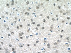 C15orf29 Rabbit anti-Human, Mouse, Rat, Polyclonal, Proteintech:Antibodies:Primary
