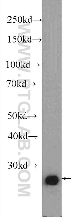 C15orf29 Rabbit anti-Human, Mouse, Rat, Polyclonal, Proteintech:Antibodies:Primary
