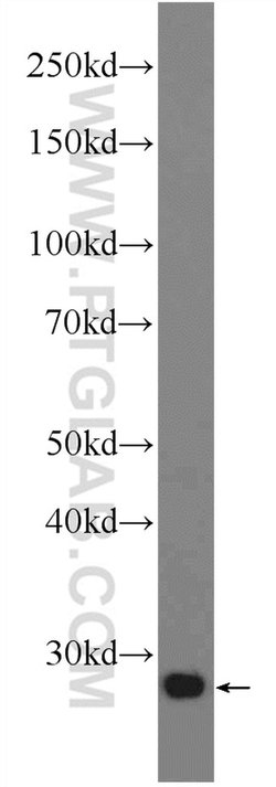 C15orf29 Rabbit anti-Human, Mouse, Rat, Polyclonal, Proteintech:Antibodies:Primary