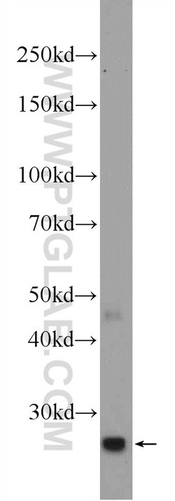 C15orf29 Rabbit anti-Human, Mouse, Rat, Polyclonal, Proteintech:Antibodies:Primary