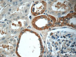 FAM174A Rabbit anti-Human, Polyclonal, Proteintech 150 &mu;L; Unconjugated:Antibodies,