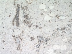 TMEM154 Rabbit anti-Human, Polyclonal, Proteintech:Antibodies:Primary Antibodies