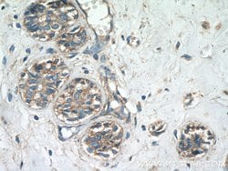 TMEM154 Rabbit anti-Human, Polyclonal, Proteintech:Antibodies:Primary Antibodies