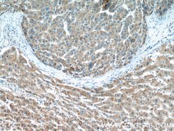 DMGDH Rabbit anti-Human, Mouse, Rat, Polyclonal, Proteintech:Antibodies:Primary