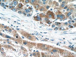 DMGDH Rabbit anti-Human, Mouse, Rat, Polyclonal, Proteintech:Antibodies:Primary