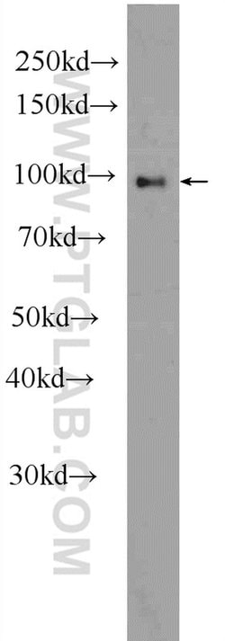 DMGDH Rabbit anti-Human, Mouse, Rat, Polyclonal, Proteintech:Antibodies:Primary