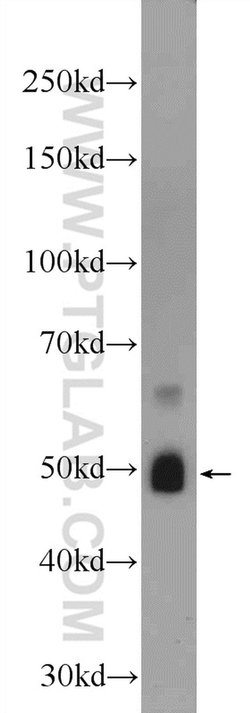 ZRANB2 Rabbit anti-Human, Mouse, Polyclonal, Proteintech:Antibodies:Primary
