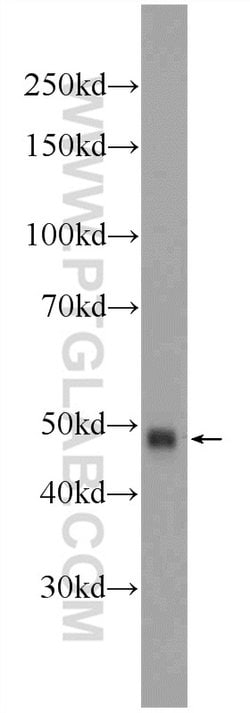 ZRANB2 Rabbit anti-Human, Mouse, Polyclonal, Proteintech:Antibodies:Primary