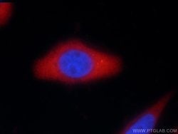 Vertnin Rabbit anti-Human, Polyclonal, Proteintech 150 &mu;L; Unconjugated:Antibodies,