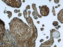 Vertnin Rabbit anti-Human, Polyclonal, Proteintech 150 &mu;L; Unconjugated:Antibodies,